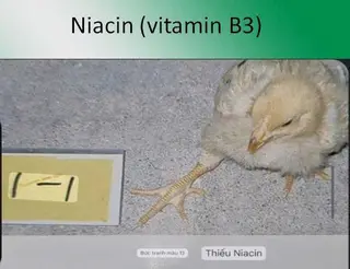 Bại chân - triệu chứng dễ nhầm lẫn, giải pháp phải từ dinh dưỡng
