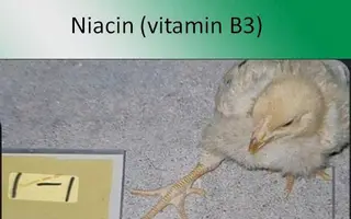 Bại chân - triệu chứng dễ nhầm lẫn, giải pháp phải từ dinh dưỡng